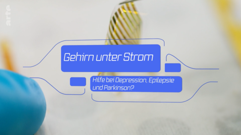 Medientipps artegehirnunterstrom